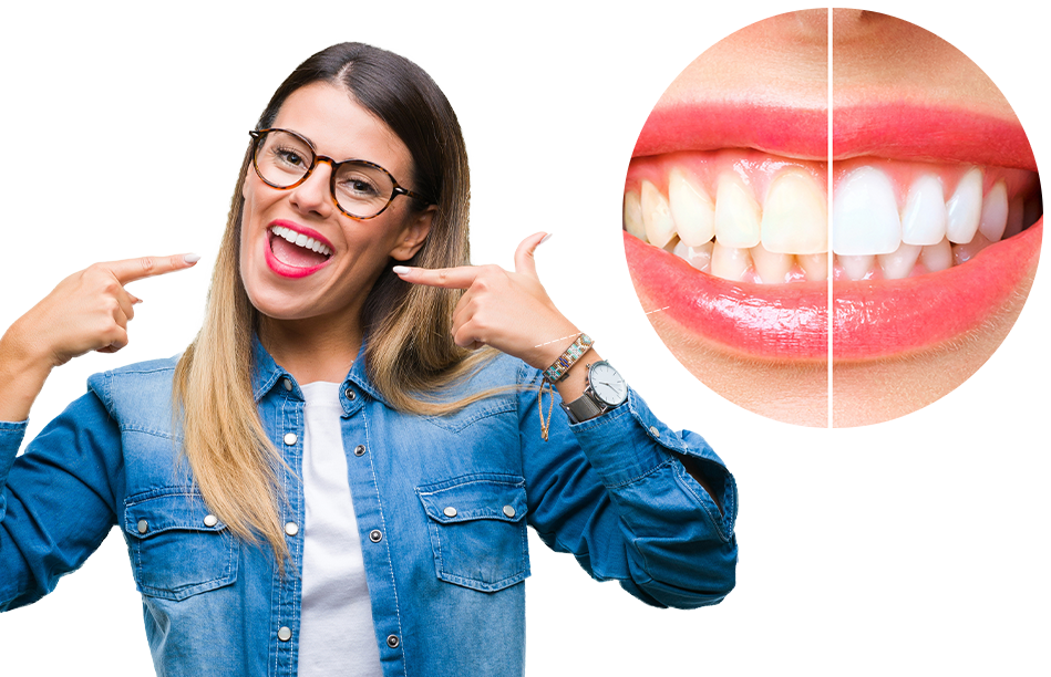 Teeth Whitening Reynoldsburg Ohio