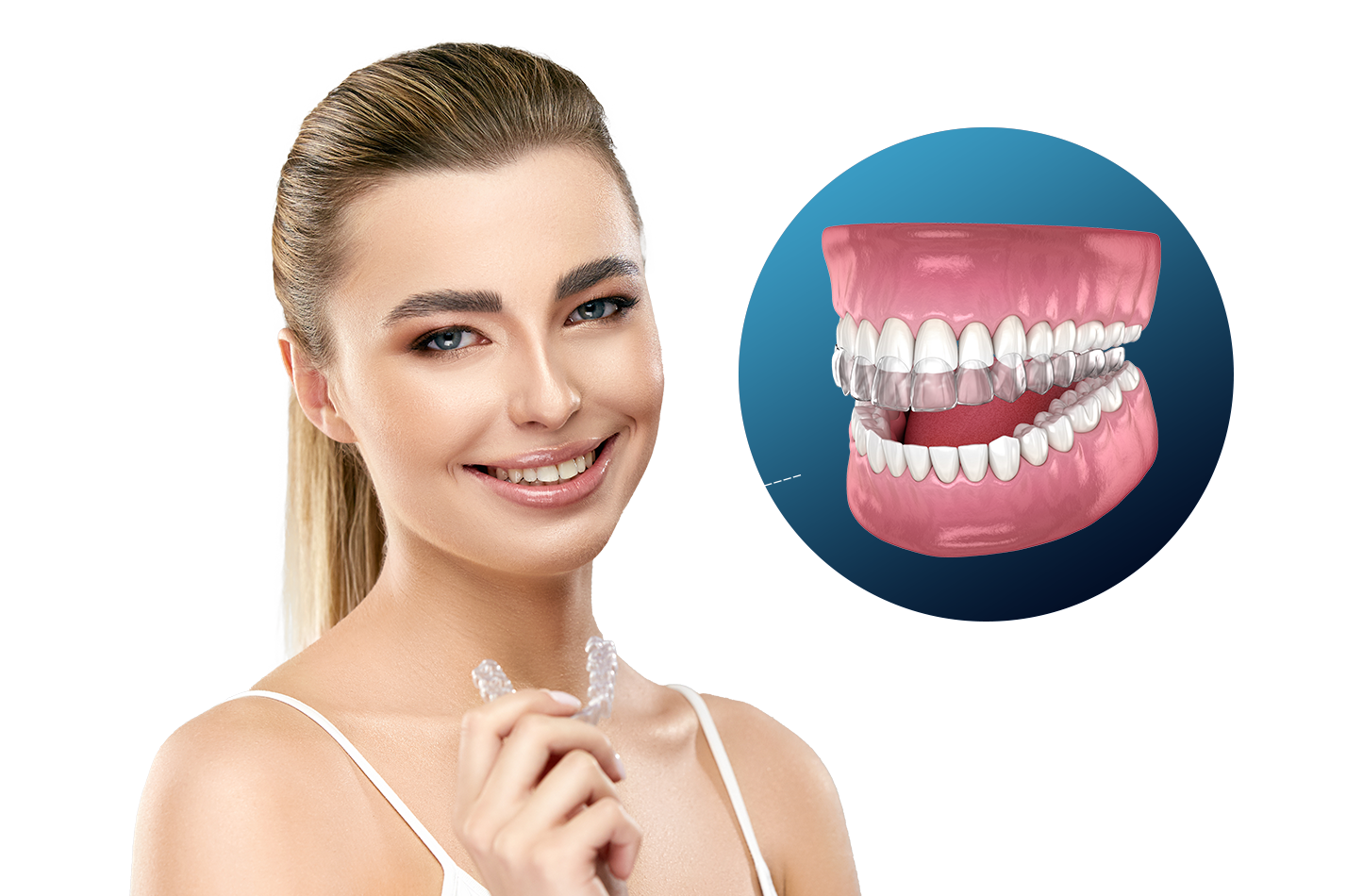 The Advantages and Process of Invisalign Treatment for a Straighter Smile